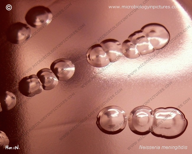 Neisseria meningitidis colonies, cultivation 48 hours neisseria meningitidis raised colonies